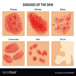 Rashes in skin