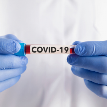 COVID ANTIBODY